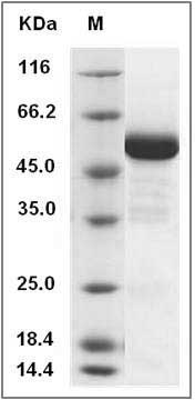 Canine RBP4 Protein (Fc Tag) SDS-PAGE