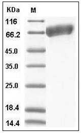 Mouse ALCAM / CD166 Protein (His Tag) SDS-PAGE