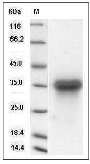 Rat LTBR / TNFRSF3 Protein (His Tag) SDS-PAGE
