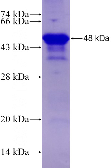 Human BCL11A Recombinant protein (6*His tag)