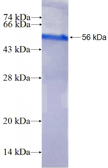 Recombinant Human SYT11 SDS-PAGE