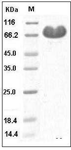 Human CD112 / Nectin-2 / PVRL2 Protein (Fc Tag) SDS-PAGE