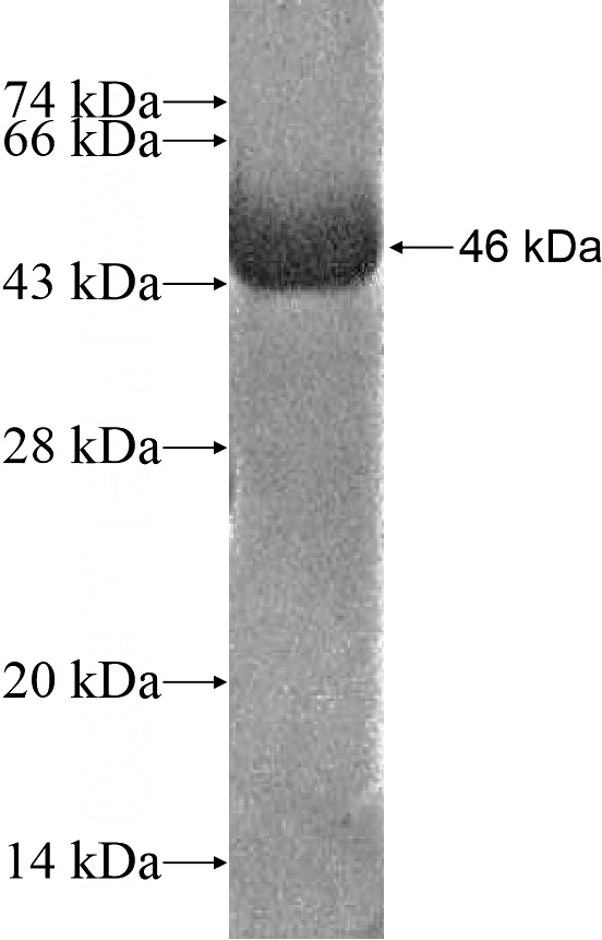 Recombinant Human ASTN1 SDS-PAGE