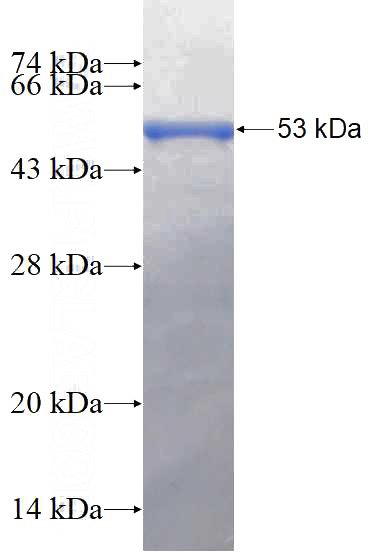 Human Integrin alpha-6 Recombinant protein (GST tag)