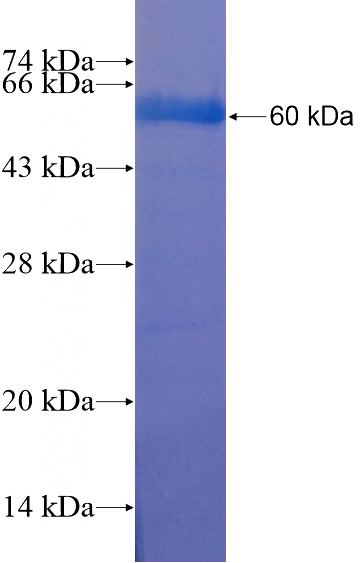 Recombinant Human LRRIQ1 SDS-PAGE