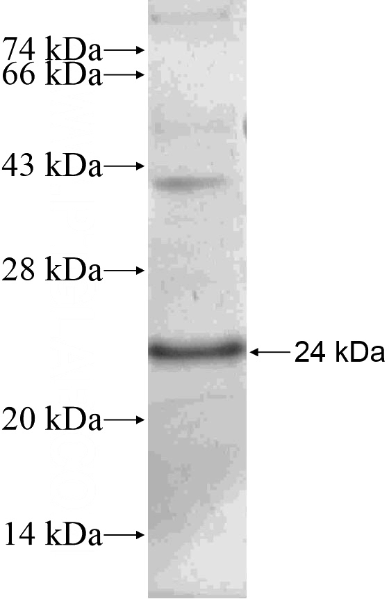 Recombinant Human STAC2 SDS-PAGE