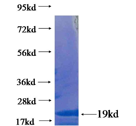 Recombinant human HOXC6 SDS-PAGE