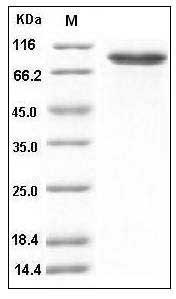 Human DDR2 Kinase / CD167b Protein (Fc Tag) SDS-PAGE