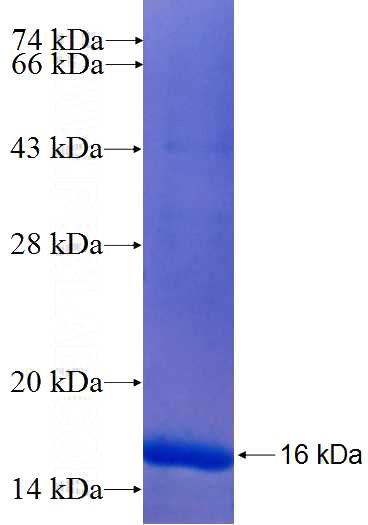 Recombinant Human Neurofibromin SDS-PAGE