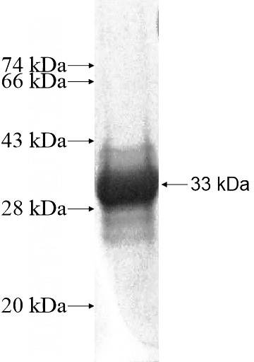 Recombinant Human SNRNP27 SDS-PAGE