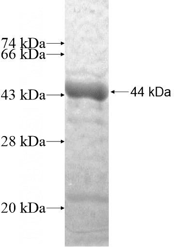 Recombinant Human TTLL6 SDS-PAGE