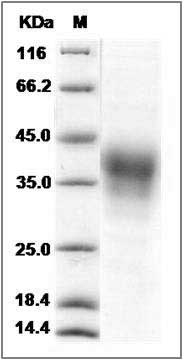 Cynomolgus CD153 / CD30L / TNFSF8 Protein (His Tag) SDS-PAGE