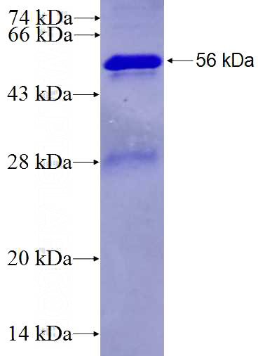 Recombinant Human RPS3A SDS-PAGE