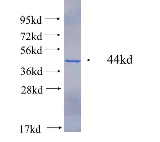 Recombinant human CEP72 SDS-PAGE