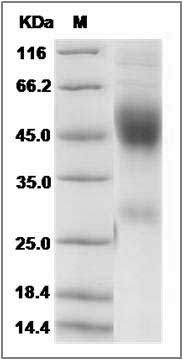 Mouse Neurexophilin-1 / NXPH1 Protein (His Tag) SDS-PAGE