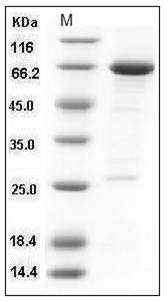Human HDAC8 / HDACL1 Protein (GST Tag) SDS-PAGE