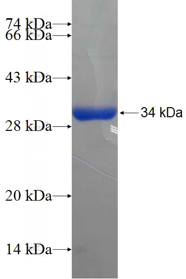 Recombinant Human ATPBD4 SDS-PAGE