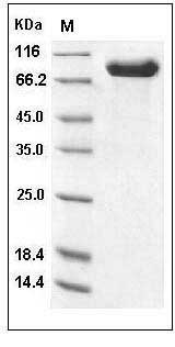Human IL-1R9 / IL1RAPL2 Protein (Fc Tag) SDS-PAGE