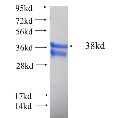 Recombinant human TRIM31 SDS-PAGE