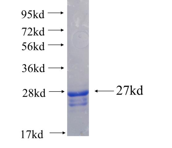 Recombinant human RPP25(Full length) SDS-PAGE