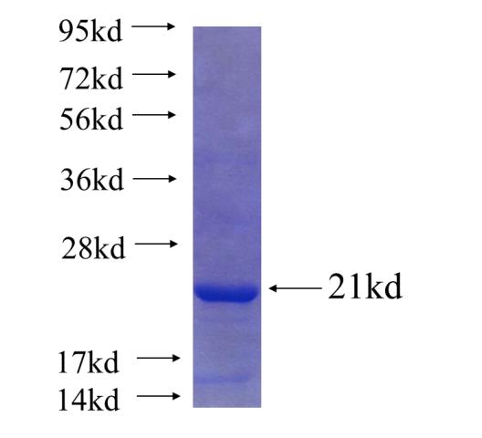 Recombinant human DYDC1 SDS-PAGE