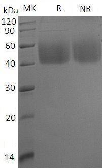 Human NCR3LG1/B7H6 (His tag) recombinant protein