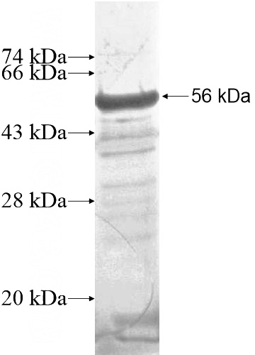 Recombinant Human C8orf34 SDS-PAGE