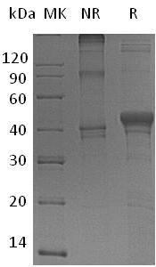 Human DFFA/DFF1/DFF45/H13 (His tag) recombinant protein