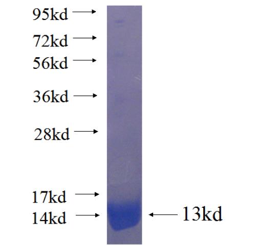 Recombinant human GPM6B SDS-PAGE