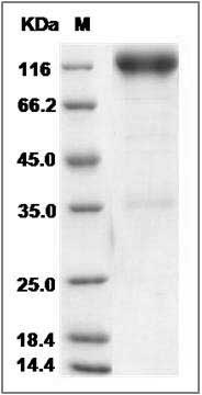 Rat PDGFRB / PDGFR-1 Protein (Fc Tag) SDS-PAGE