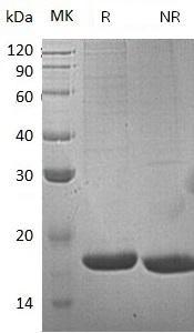 Mouse Reg2 (His tag) recombinant protein