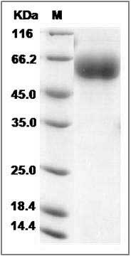 Human AMIGO2 Protein (His Tag) SDS-PAGE