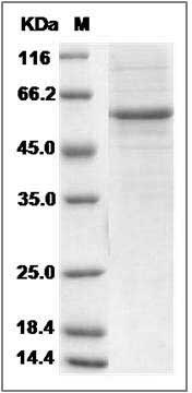Rat MBL1 Protein (Fc Tag) SDS-PAGE