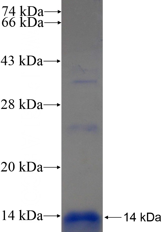 Recombinant Human ALG6 SDS-PAGE