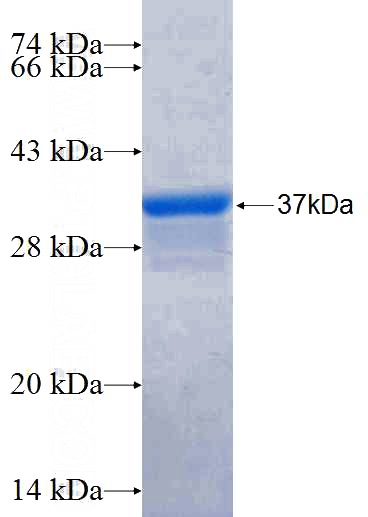 Recombinant Human AS3MT SDS-PAGE