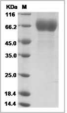 Influenza A H3N2 (A/Victoria/208/2009) Hemagglutinin / HA1 Protein (His Tag)
