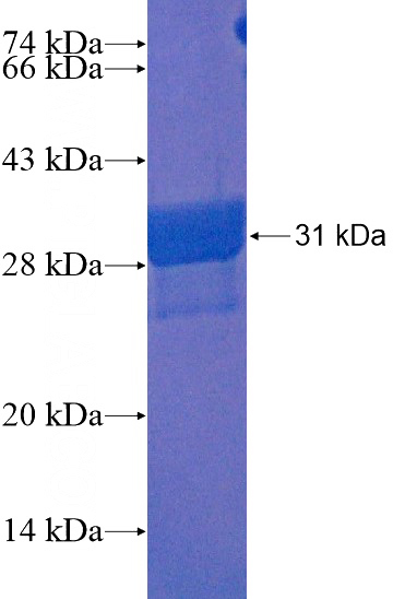 Human TMEM106B Recombinant protein (GST tag)