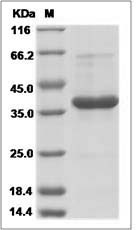 Human PF4V1 Protein (Fc Tag)