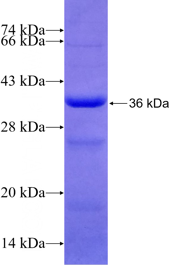 Recombinant Human MED17 SDS-PAGE