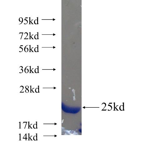 Recombinant human PLA2G12A SDS-PAGE