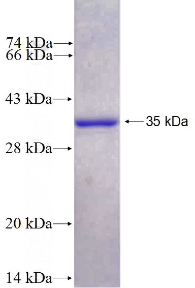 Recombinant Human CAMK2N2 SDS-PAGE