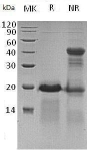 Human APBA3/MINT3/X11L2 (His tag) recombinant protein