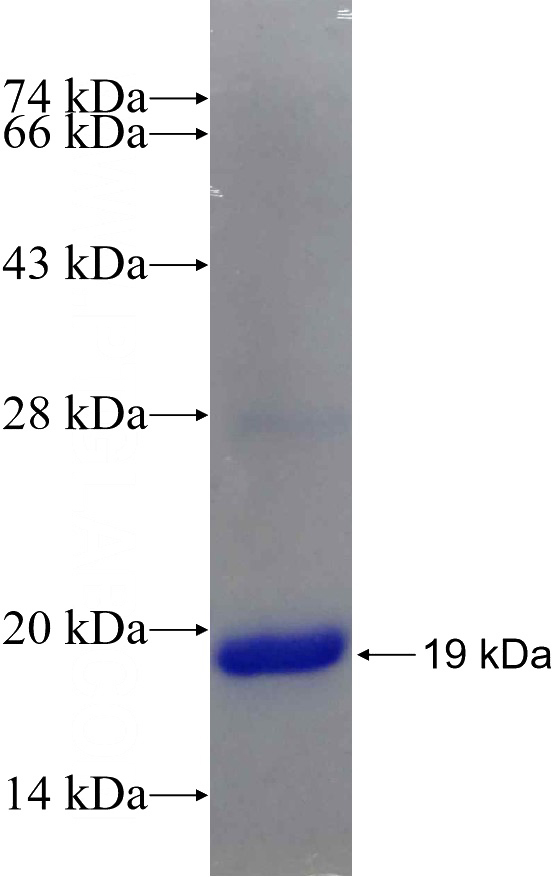 Recombinant Human AHCYL2 SDS-PAGE