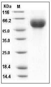 Influenza A H1N1 (A/California/04/2009) Hemagglutinin Protein (HA1 Subunit) (His Tag) SDS-PAGE