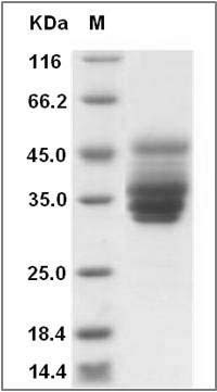 Human IFITM3 Protein (Fc Tag) SDS-PAGE
