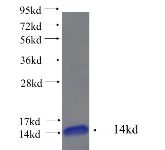 Recombinant human CHST6 SDS-PAGE