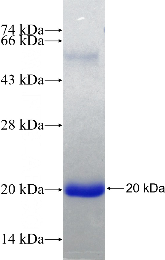 Recombinant Human SGMS1 SDS-PAGE