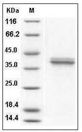 Human Cathepsin V / Cathepsin L2 / Preproprotein Protein (His Tag) SDS-PAGE