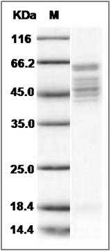 Human RSV Fusion protein / RSV-F (Strain RSS-2) Protein (His Tag) SDS-PAGE