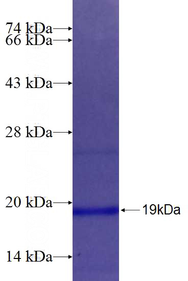 Recombinant Human GRIA1 SDS-PAGE